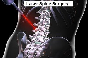 Spine Surgery in Nashik